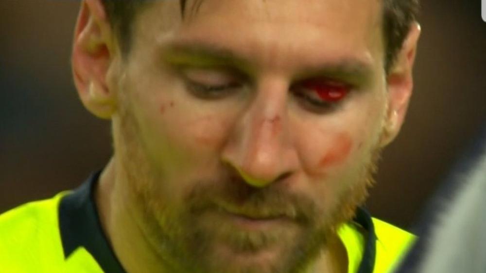 فالفيردي: "ميسي تعرض لضربة قوية... غدا سيخضع للفحص"