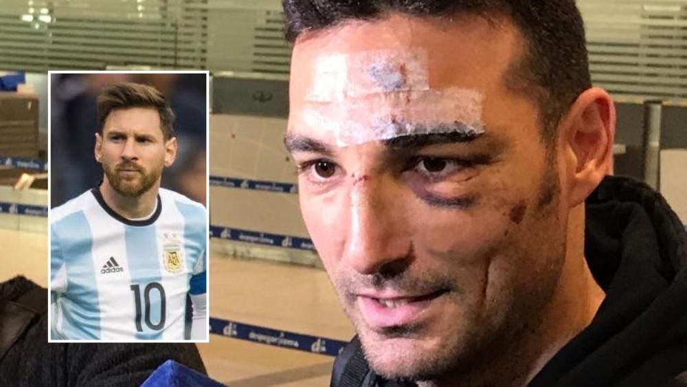 مدرب الأرجنتين: "أنا المسؤول عن غياب ميسي أمام المغرب"