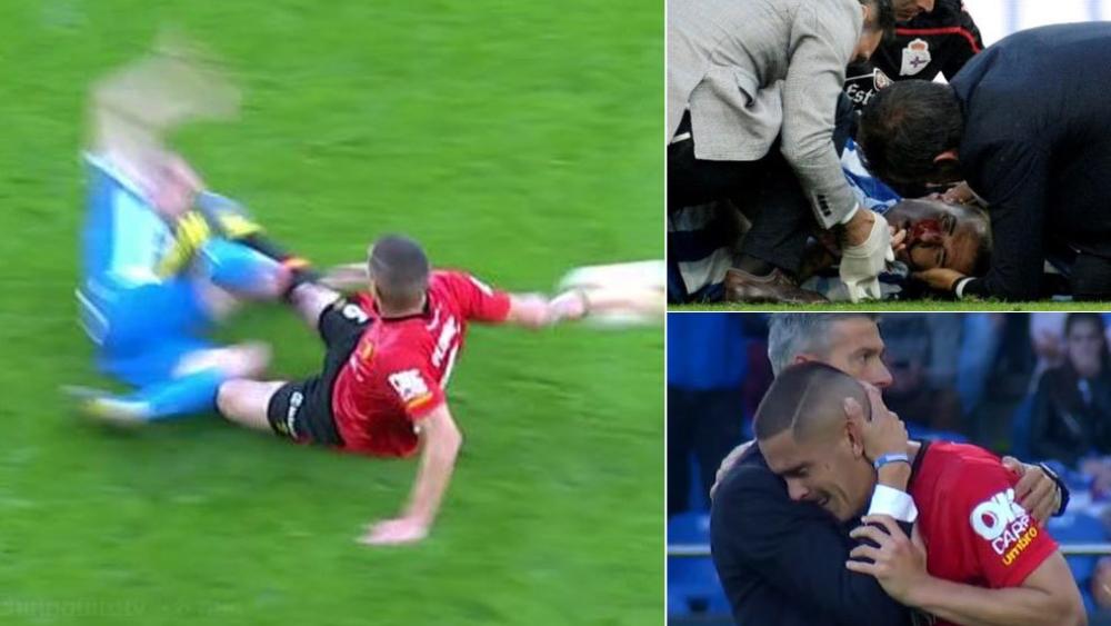 بالصور | لاعب الديبور يتعرض لإصابة "خطيرة" في الوجه ويصيب الجماهير بالصدمة!