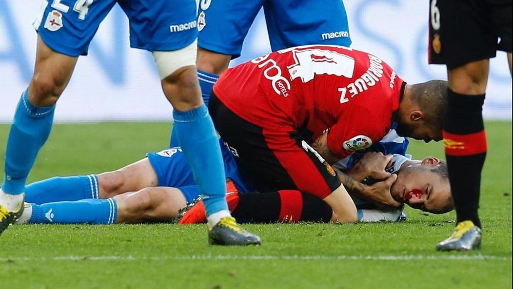 شاهد بالصور | هكذا أصبح وجه لاعب الديبور بعد إصابة تسببت له في 70 غرزة!