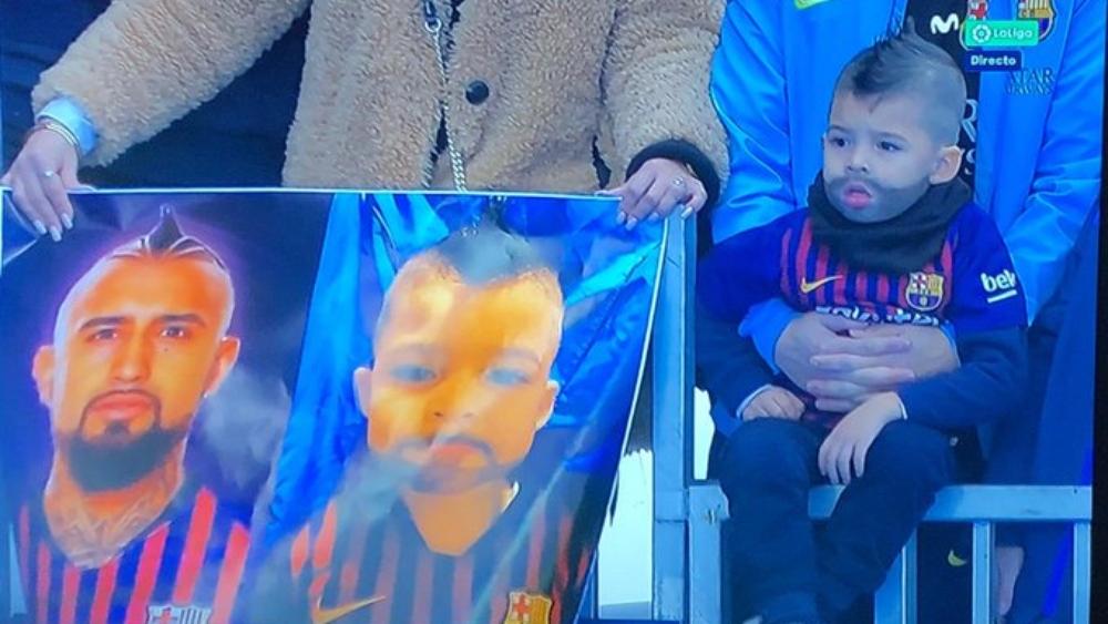 "مجنون" فيدال يُحول ابنه إلى "نسخة مصغرة" من النجم التشيلي