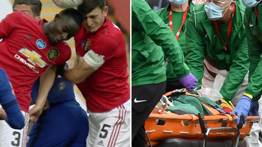 نقل مدافع اليونايتد بايلي إلى المستشفى بعد "إصابتين خطيرتين" على مستوى الرأس!