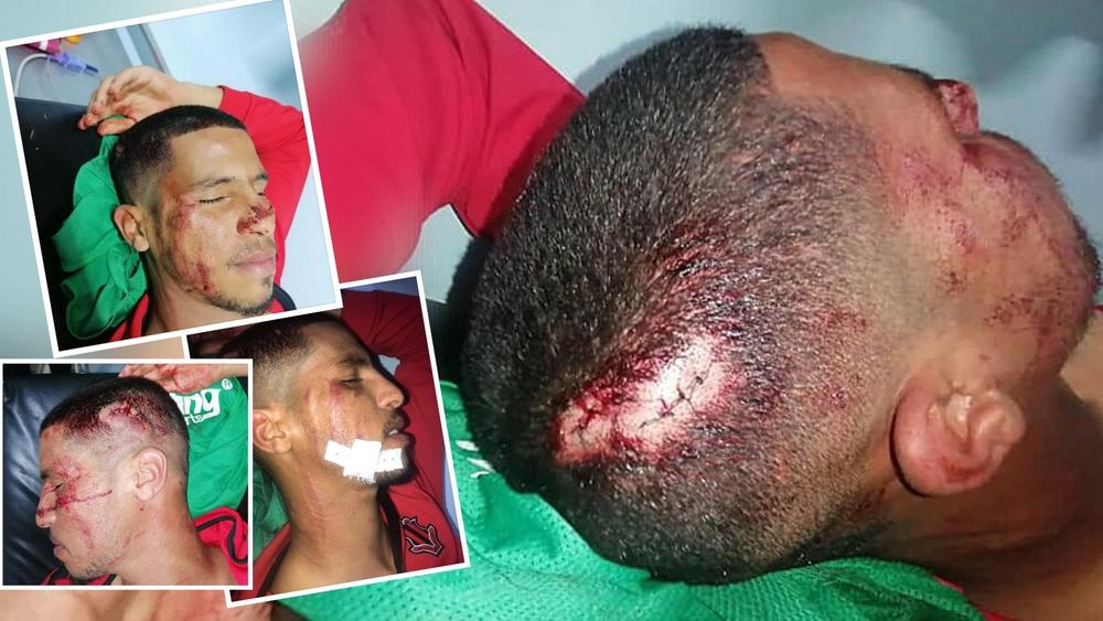لاعبو الاتحاد القاسمي يتعرضون لـ"اعتداء شنيع" في الداخلة.. "16 غرزة" في مختلف أنحاء جسم اللاعب أيوب الداودي!