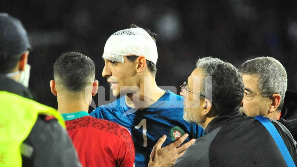 بونو يسعى للِّحاق بمباراة إشبيلية وبرشلونة الأحد القادم في "الليغا"