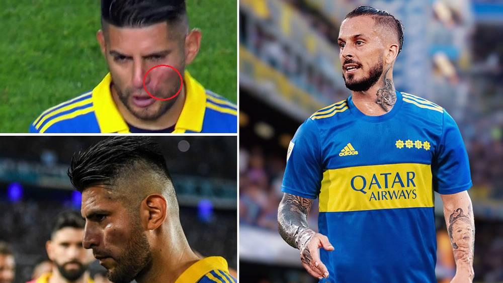 شجار بين زامبرانو وبينيديتو في مستودع ملابس بوكا جونيورز ينتهي بإصابة الأول على مستوى الوجه!