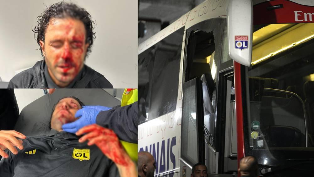 رسميا/ عدم إجراء مباراة مارسيليا ضد ليون بسبب شغب الجماهير!