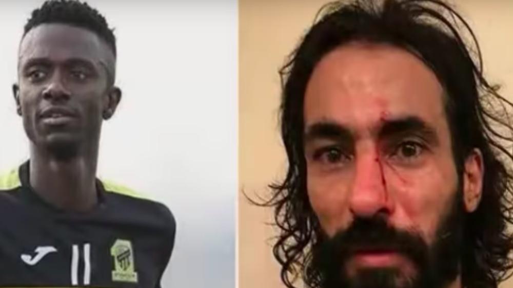 إيقاف نجم اتحاد جدة لعامين بعد إسالة دماء حسين عبد الغني