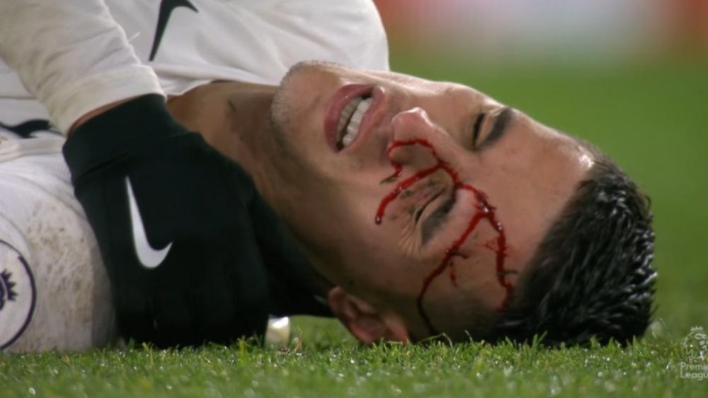 لاميلا يتعرض لإصابة خطيرة خلال حسم توتنهام للديربي