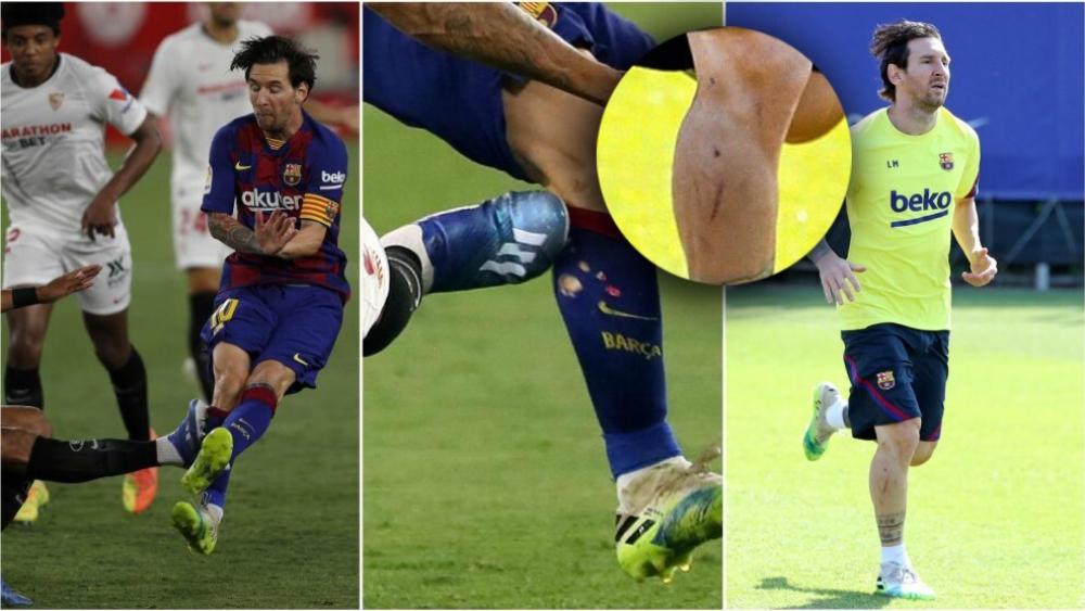 بالصور | صحف إسبانية "تُظهر" جروح ميسي وتكشف سبب "غضبته" على مدافع إشبيلية!