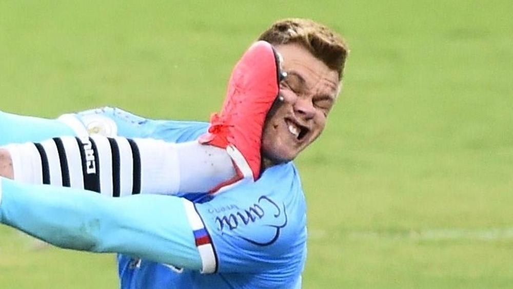 حارس باهيا البرازيلي يتعرض لتدخل "غير رياضي" يتسبب له في "5 غرزات" في الوجه!