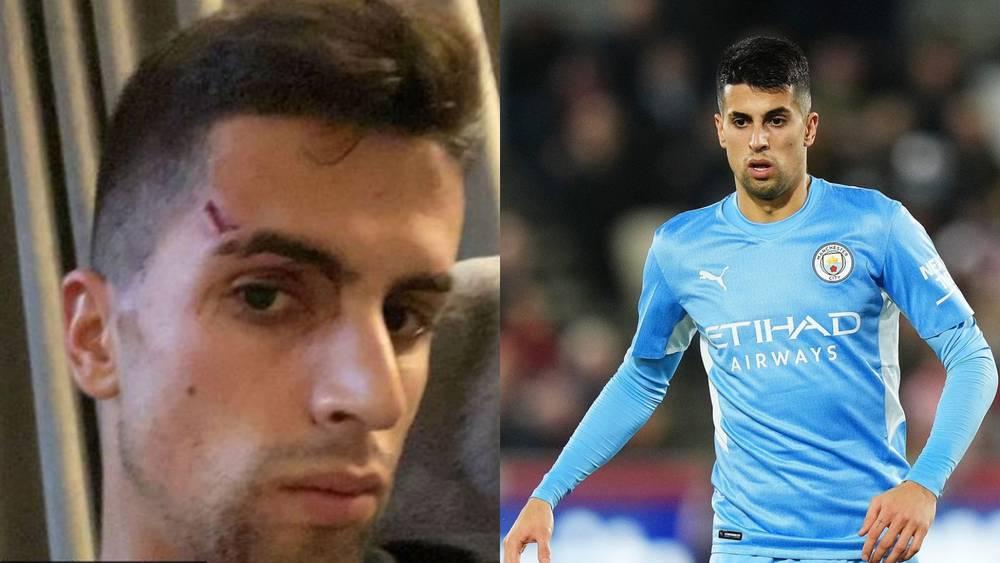 كانسيلو يتعرض لاعتداء في الوجه وسرقة مجوهرات تحت تهديد السلاح